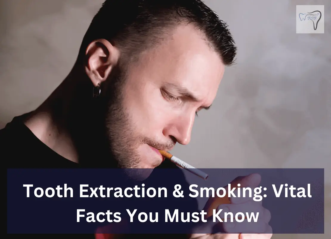 Tooth Extraction & Smoking Vital Facts You Must Know