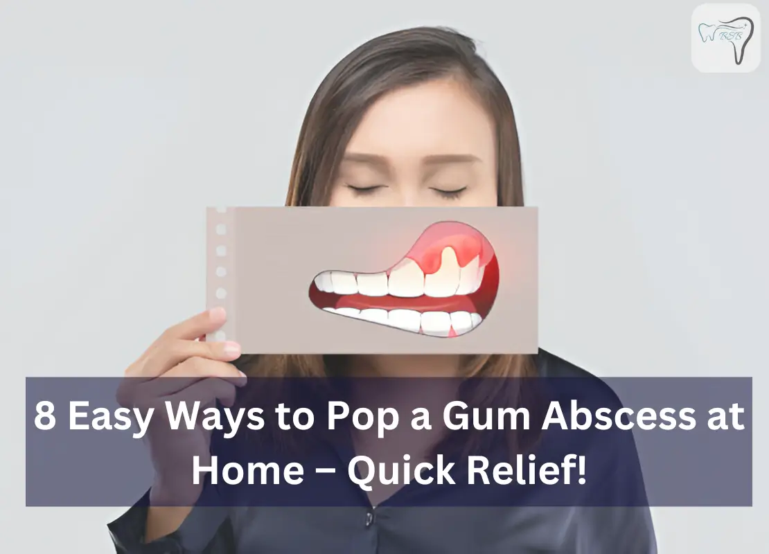 8 Easy Ways to Pop a Gum Abscess at Home – Quick Relief!