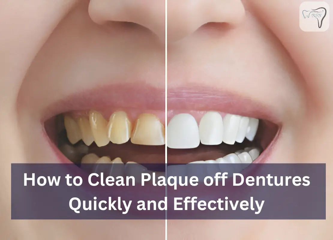 How to Clean Plaque off Dentures Quickly and Effectively