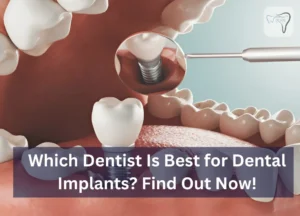 Which Dentist Is Best for Dental Implants? Find Out Now!