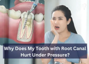 Why Does My Tooth with Root Canal Hurt Under Pressure