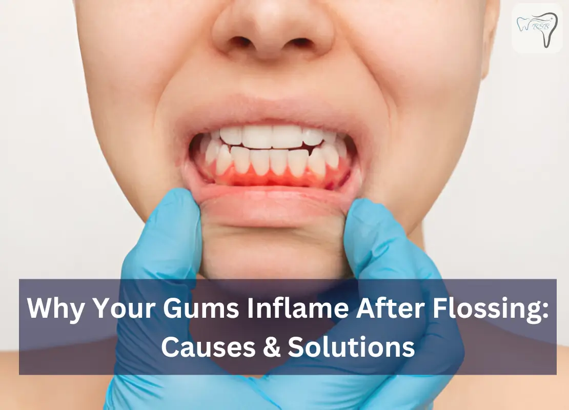 Why Your Gums Inflame After Flossing: Causes & Solutions